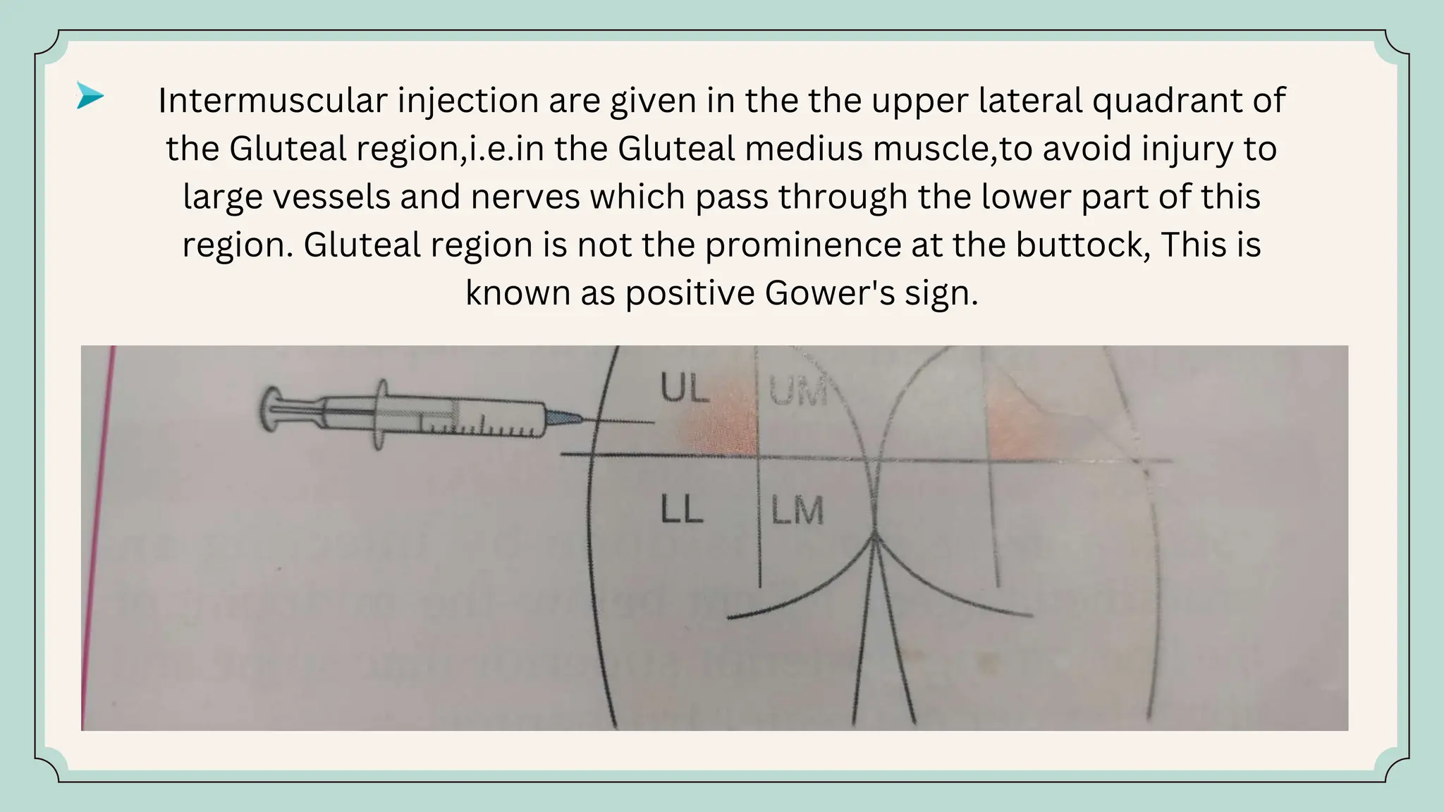 Muscle of Gluteal region and their clinical significance .ppt Reshi ...