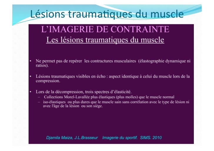 Imagerie des Lésions Musculaires Imagerie des Lésions Musculaires