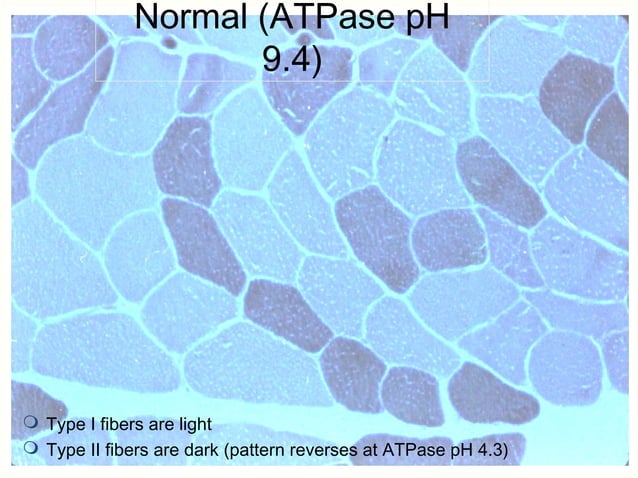 Myopathies - In detail (Classification and images) | PPT