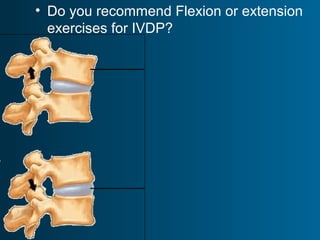 • Do you recommend Flexion or extension
exercises for IVDP?
 