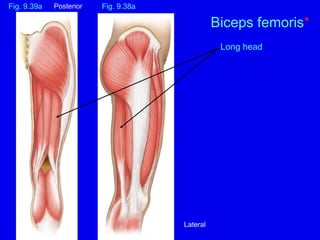 Biceps femoris*
Long head
Fig. 9.39a Fig. 9.38a
Posterior
Lateral
 