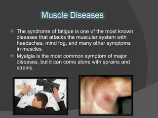 The syndrome of fatigue is one of the most known diseases that attacks the muscular system with headaches, mind fog, and many other symptoms in muscles. Myalgia is the most common symptom of major diseases, but it can come alone with sprains and strains. 