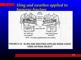 Sling and swathes applied to humerus fracture 