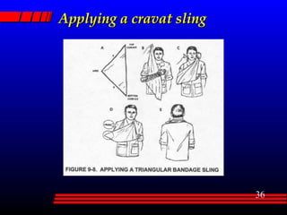 Applying a cravat sling 