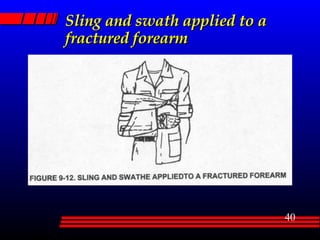 Sling and swath applied to a fractured forearm 