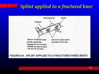Splint applied to a fractured knee 
