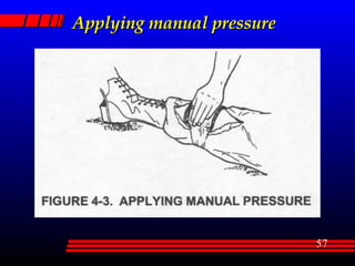 Applying manual pressure 