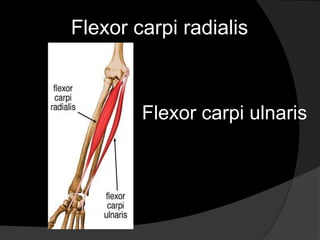 	Flexor carpi radialis  Flexor carpi ulnaris