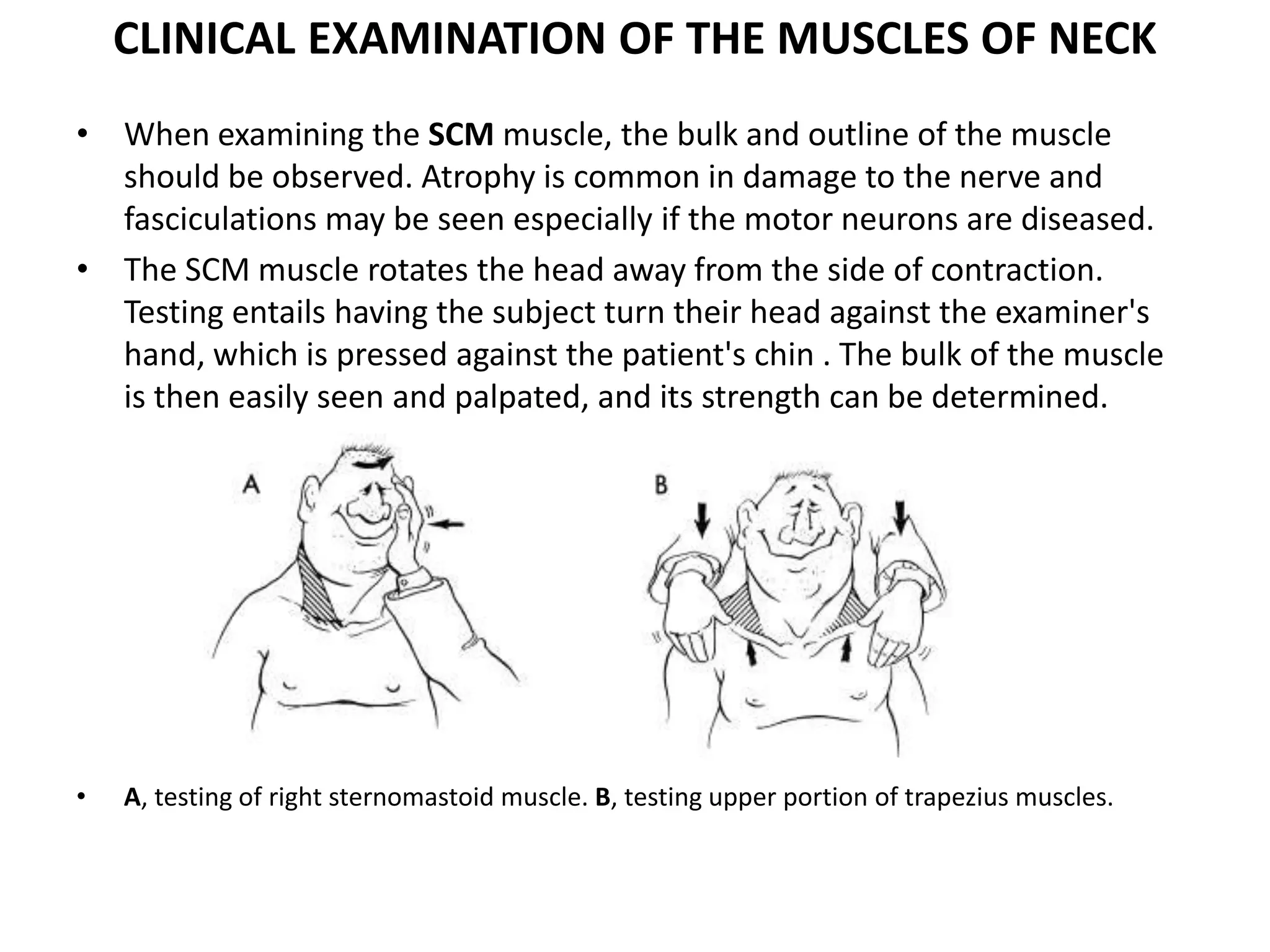 CLINICAL EXAMINATION OF THE MUSCLES OF NECK
• When examining the SCM muscle, the bulk and outline of the muscle
should be observed. Atrophy is common in damage to the nerve and
fasciculations may be seen especially if the motor neurons are diseased.
• The SCM muscle rotates the head away from the side of contraction.
Testing entails having the subject turn their head against the examiner's
hand, which is pressed against the patient's chin . The bulk of the muscle
is then easily seen and palpated, and its strength can be determined.
• A, testing of right sternomastoid muscle. B, testing upper portion of trapezius muscles.
 