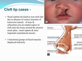 Muscles of facial expression | PPTX