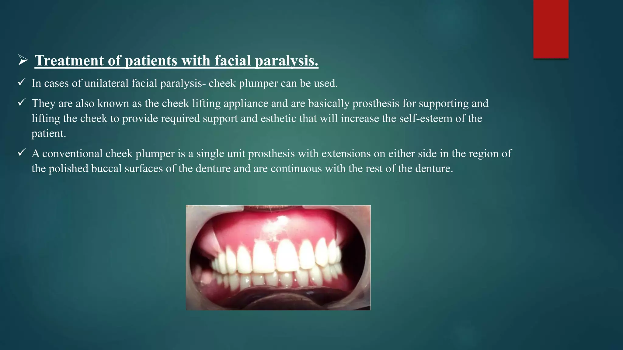  Treatment of patients with facial paralysis.
 In cases of unilateral facial paralysis- cheek plumper can be used.
 They are also known as the cheek lifting appliance and are basically prosthesis for supporting and
lifting the cheek to provide required support and esthetic that will increase the self-esteem of the
patient.
 A conventional cheek plumper is a single unit prosthesis with extensions on either side in the region of
the polished buccal surfaces of the denture and are continuous with the rest of the denture.
 