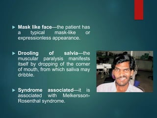Muscles of facial expressions | PPTX