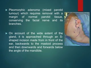 Parotid Incision Types Muscles of facial expressions | PPTX