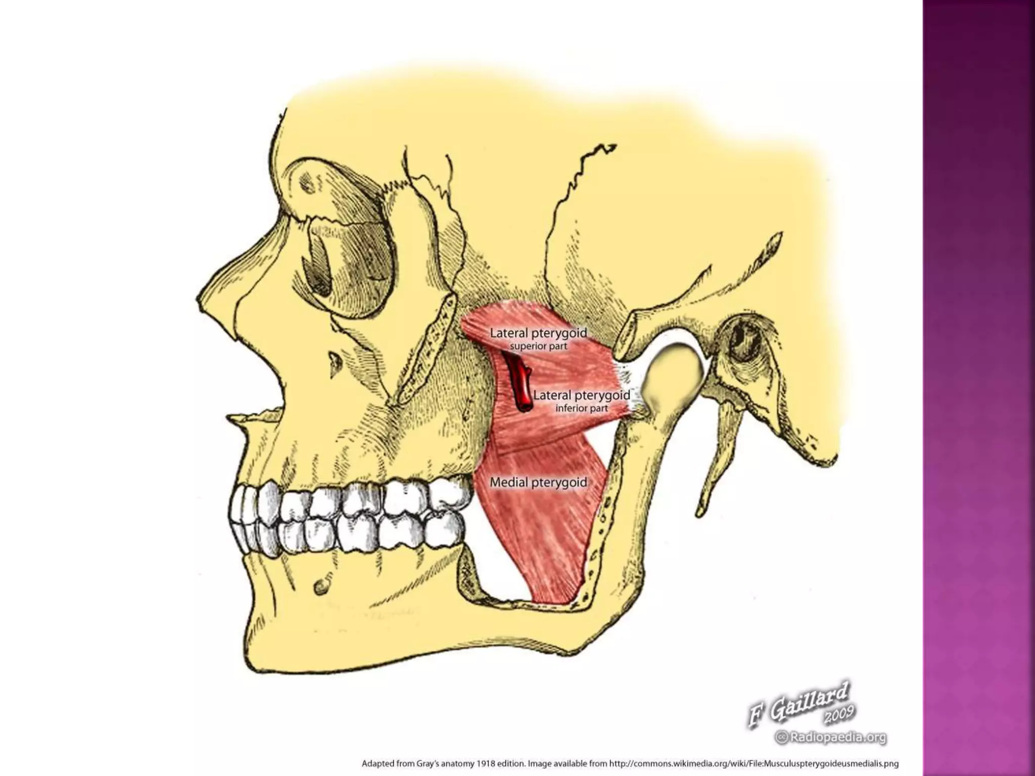 Muscles Of Mastication 9/4/2014 17 
 