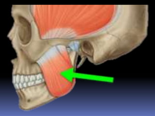 Muscles of mastication | PPTX