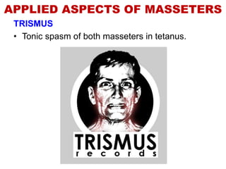 APPLIED ASPECTS OF MASSETERS
TRISMUS
• Tonic spasm of both masseters in tetanus.
 