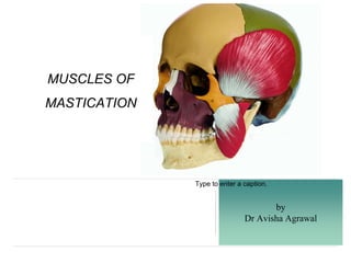 by
Dr Avisha Agrawal
Type to enter a caption.
MUSCLES OF
MASTICATION
 