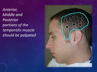 Anterior,
Middle and
Posterior
portions of the
temporalis muscle
should be palpated
 