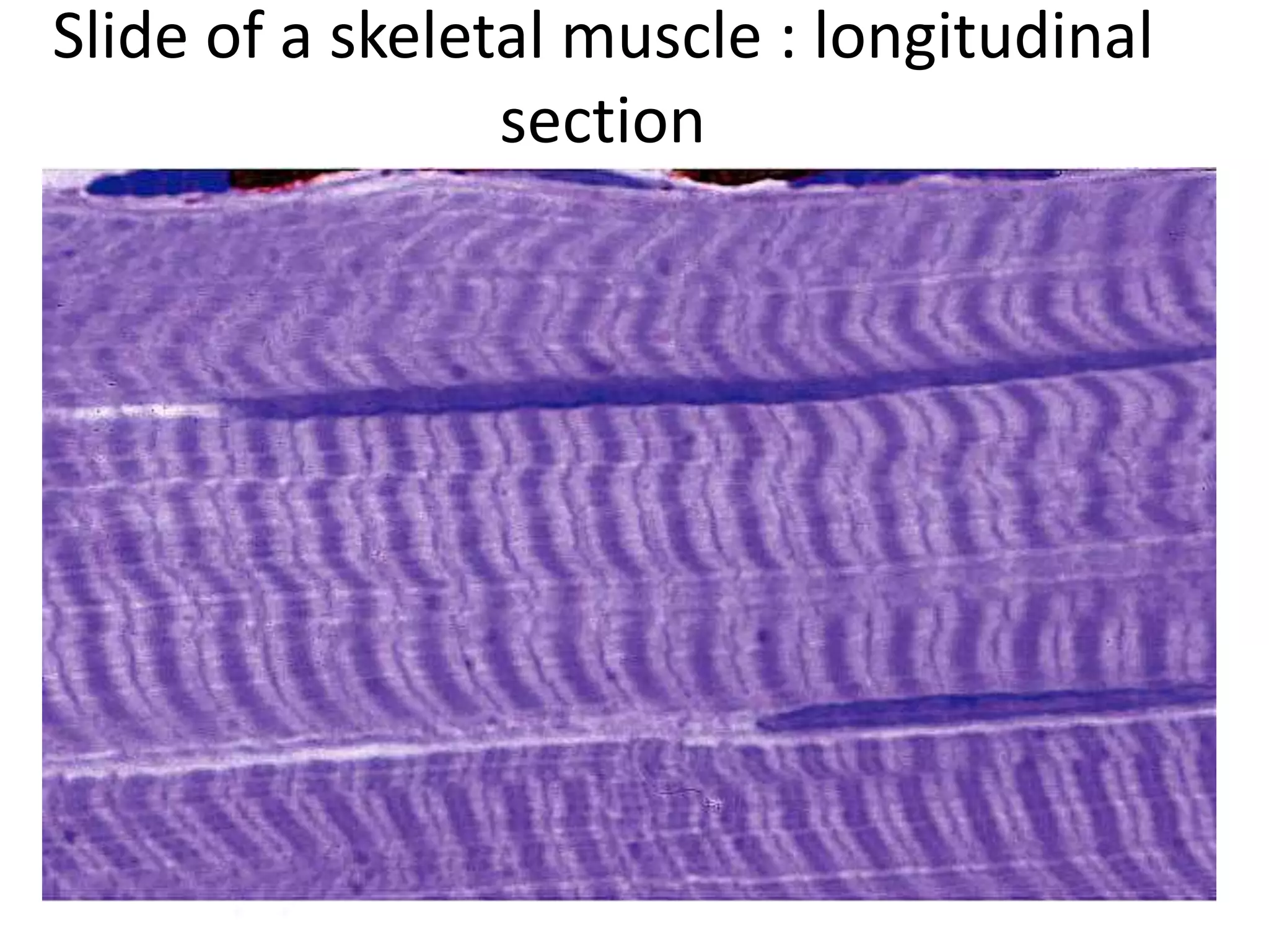 Slide of a skeletal muscle : longitudinal
section
 