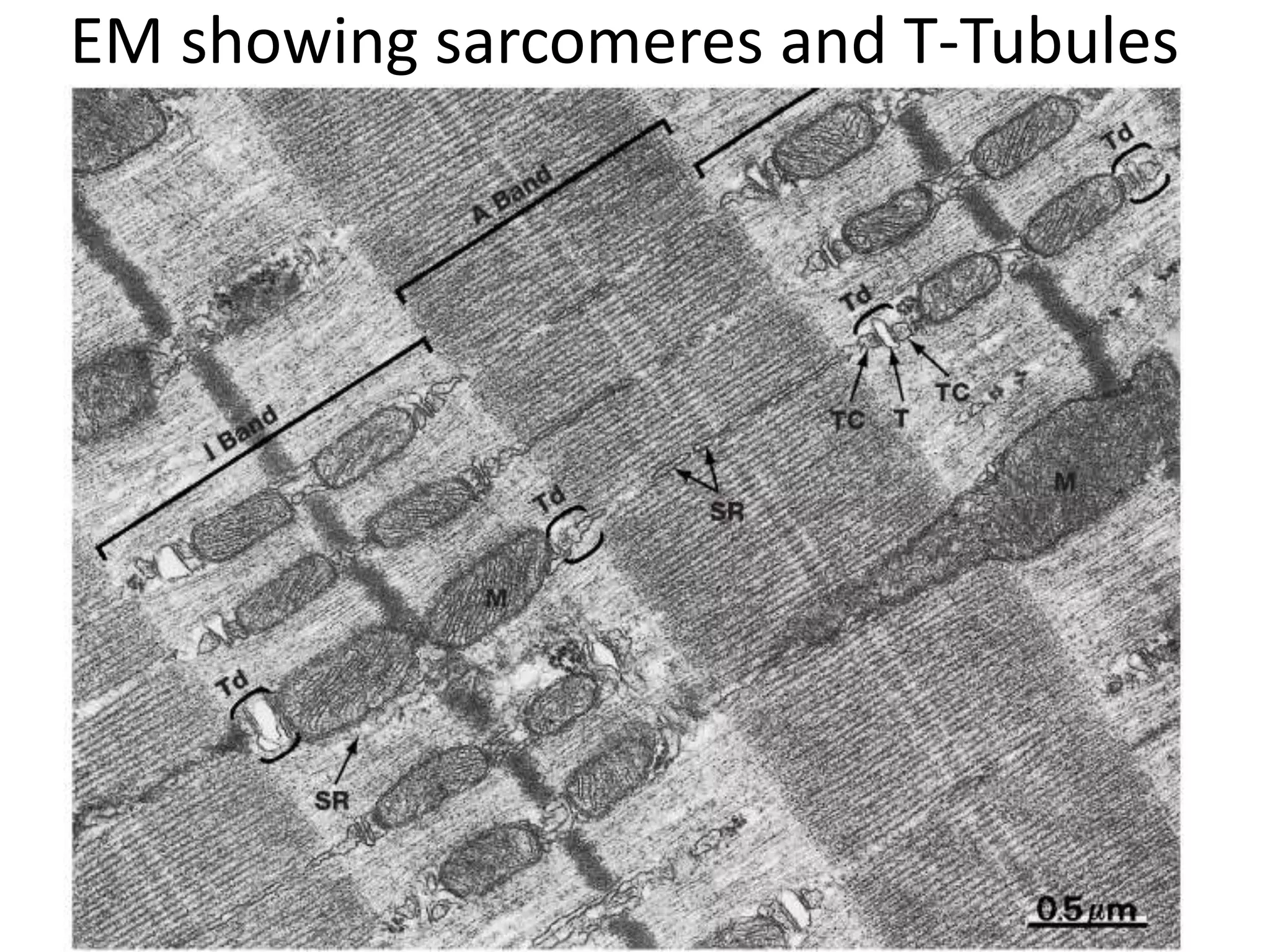 EM showing sarcomeres and T-Tubules
 