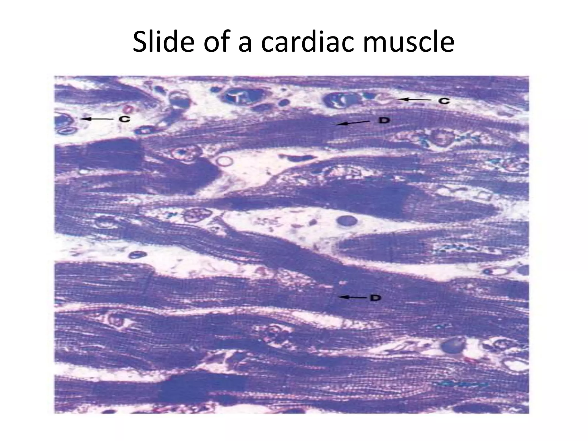 Slide of a cardiac muscle
 