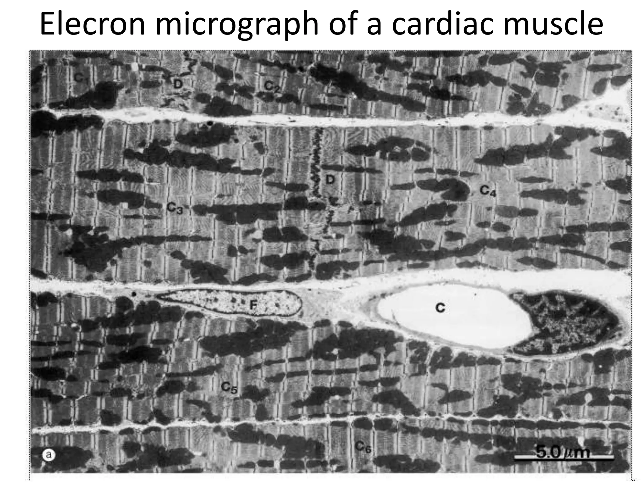 Elecron micrograph of a cardiac muscle
 