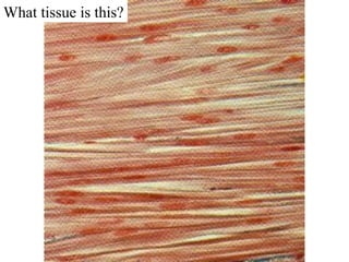 What tissue is this?
 