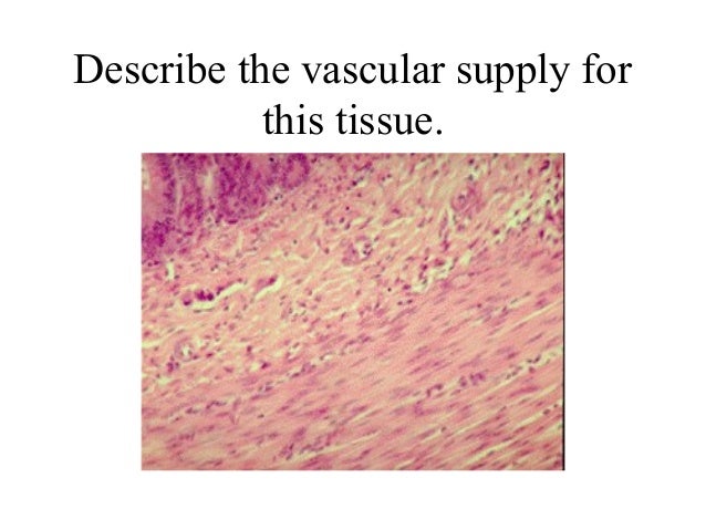 Muscle tissue practice questions