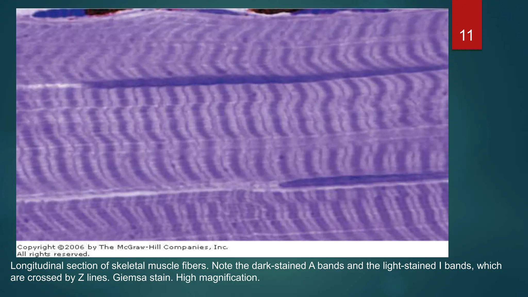 11
Longitudinal section of skeletal muscle fibers. Note the dark-stained A bands and the light-stained I bands, which
are crossed by Z lines. Giemsa stain. High magnification.
 