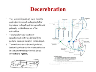 Decerebration
•

This lesion interrupts all input from the
cortex (corticospinal and corticobulbar
tracts) and red nucleus (rubrospinal tract),
primarily to distal muscles of the
extremities.

•

The excitatory and inhibitory
reticulospinal pathways (primarily to
postural extensor muscles) remain intact.

•

The excitatory reticulospinal pathway
leads to hyperactivity in extensor muscles
in all four extremities which is called
decerebrate rigidity.

 