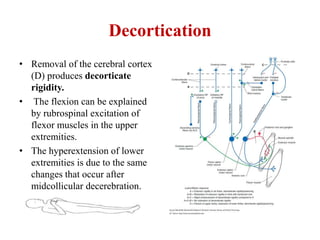Decortication
• Removal of the cerebral cortex
(D) produces decorticate
rigidity.
• The flexion can be explained
by rubrospinal excitation of
flexor muscles in the upper
extremities.
• The hyperextension of lower
extremities is due to the same
changes that occur after
midcollicular decerebration.

 