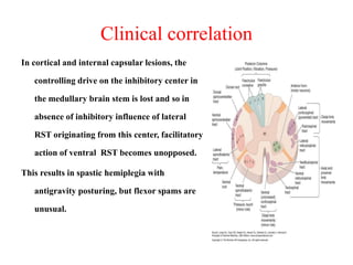 Clinical correlation
In cortical and internal capsular lesions, the
controlling drive on the inhibitory center in

the medullary brain stem is lost and so in
absence of inhibitory influence of lateral
RST originating from this center, facilitatory

action of ventral RST becomes unopposed.
This results in spastic hemiplegia with
antigravity posturing, but flexor spams are
unusual.

 