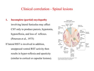 Clinical correlation - Spinal lesions
1.

Incomplete (partial) myelopathy

involving lateral funiculus may affect
CST only to produce paresis, hypotonia,
hyporeflexia, and loss of reflexes.
(Peterson et al., 1975)
If lateral RST is involved in addition,
unopposed ventral RST activity then
results in hyper-reflexia and spasticity

(similar to cortical or capsular lesions).

 