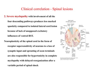 Clinical correlation - Spinal lesions
2. Severe myelopathy with involvement of all the
four descending pathways produces less marked

spasticity compared to isolated lateral cord lesion
because of lack of unopposed excitatory
influences of ventral RST.

Neuroplasticity of the spinal cord in the form of
receptor supersensitivity of neurons to a loss of
synaptic input and sprouting of axon terminals
are also responsible for hypertonicity in complete
myelopathy with delayed reorganization after a
variable period of spinal shock

 