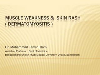 MUSCLE WEAKNESS & SKIN RASH
( DERMATOMYOSITIS )



Dr. Mohammad Tanvir Islam
Assistant Professor , Dept of Medicine
Bangabandhu Sheikh Mujib Medical University, Dhaka, Bangladesh
 
