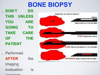 BONE BIOPSY
DON’T DO
THIS UNLESS
YOU ARE
GOING TO
TAKE CARE
OF THE
PATIENT
Performed
AFTER the
imaging
evaluation is
 