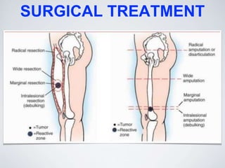 SURGICAL TREATMENT
 