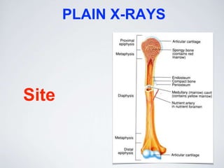 PLAIN X-RAYS
Site
 