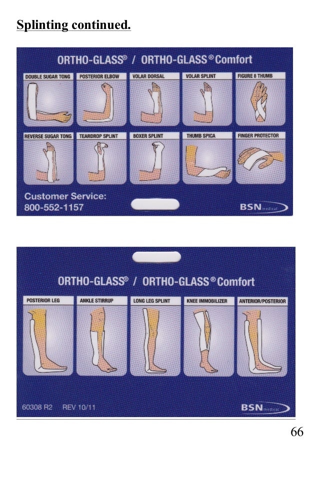 Ortho Glass Splints Chart