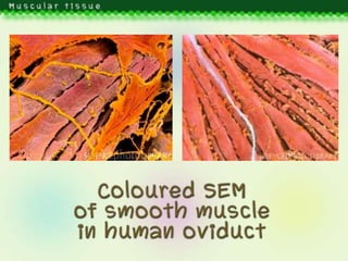 Muscular