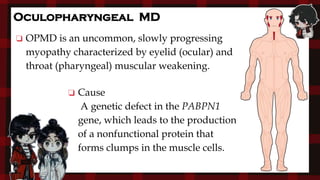 ❏ Cause
A genetic defect in the PABPN1
gene, which leads to the production
of a nonfunctional protein that
forms clumps in the muscle cells.
❏ OPMD is an uncommon, slowly progressing
myopathy characterized by eyelid (ocular) and
throat (pharyngeal) muscular weakening.
Oculopharyngeal MD
 