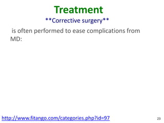 Treatment
                 **Corrective surgery**
   is often performed to ease complications from
   MD:




http://www.fitango.com/categories.php?id=97        23
 
