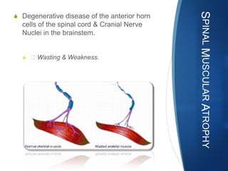 SPINAL MUSCULAR ATROPHY
S Degenerative disease of the anterior horn
  cells of the spinal cord & Cranial Nerve
  Nuclei in the brainstem.


  S Wasting & Weakness.
 