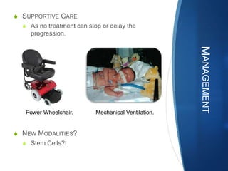 S SUPPORTIVE CARE
  S As no treatment can stop or delay the
    progression.




                                                     MANAGEMENT
   Power Wheelchair.       Mechanical Ventilation.


S NEW MODALITIES?
  S Stem Cells?!
 