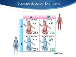 DUCHENN MUSCULAR DYSTROPHY
 