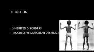 Progressive Muscle Disorder muscular dystrophies- medicine high yield easy to read slides.pptx