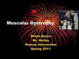 Muscular Dystrophy Dillon Quinn Mr. Holley Human Interaction Spring 2011 http:// www.google.com/imgres?imgurl =http://printwords.co.uk/wp-content/uploads/2011/01/ma2.jpeg&imgrefurl= http://printwords.co.uk/ray-hope-duchenne-muscular-dystrophy-treatment/&usg =__sbHTOB6xSimlMOQlCVBrbphJ6Dc=&h=304&w=300&sz=55&hl= en&start =195&zoom=1&tbnid= BRFxWvKmVpbReM:&tbnh =149&tbnw=135&ei=PSGeTYDcOpCavgOoq9W4BA&prev=/search%3Fq%3DMuscular%2BDystrophy%26hl%3Den%26safe%3Dactive%26sa%3DG%26biw%3D1276%26bih%3D823%26gbv%3D2%26tbm%3Disch0%2C5926&itbs=1&iact= hc&vpx =670&vpy=228&dur=1500&hovh=226&hovw=223&tx=122&ty=162&oei=FCGeTfX2EYq_0QGS0pDLBA&page=9&ndsp=28&ved=1t:429,r:25,s:195&biw=1276&bih=823 