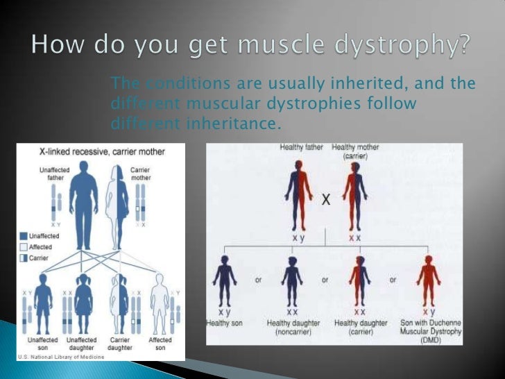 Muscular dystrophy