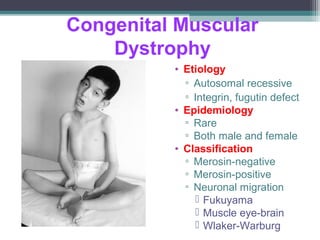Congenital Muscular
Dystrophy
• Etiology
▫ Autosomal recessive
▫ Integrin, fugutin defect
• Epidemiology
▫ Rare
▫ Both male and female
• Classification
▫ Merosin-negative
▫ Merosin-positive
▫ Neuronal migration
 Fukuyama
 Muscle eye-brain
 Wlaker-Warburg
 