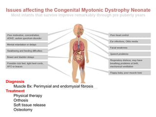Diagnosis
Muscle Bx: Perimysial and endomysial fibrosis
Treatment
Physical therapy
Orthosis
Soft tissue release
Osteotomy
 